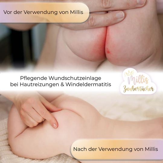 Millis Magic Wipes_produkt_galeria (3)